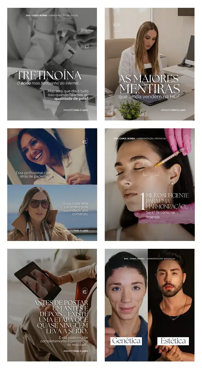 Feed do Instagram da Dra. Carol Borba, harmonizacao orofacial